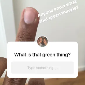 Anyone know what that green thing is?
